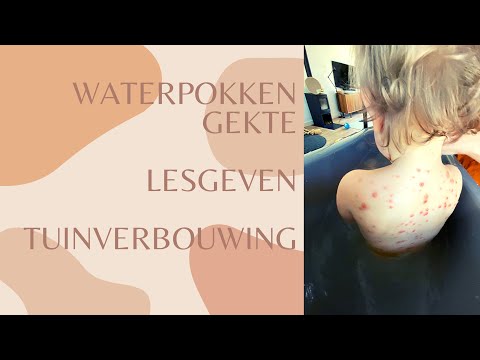 Video: Havermoutbad Voor Waterpokken