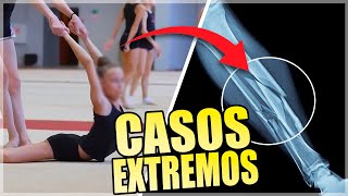 El LADO OSCURO de la GIMNASIA en NIÑOS by Mente Humana 172,864 views 2 months ago 18 minutes