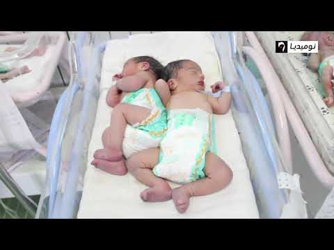 قسنطينة الولادة القيصرية وإبرة الظهر يهددان الحوامل