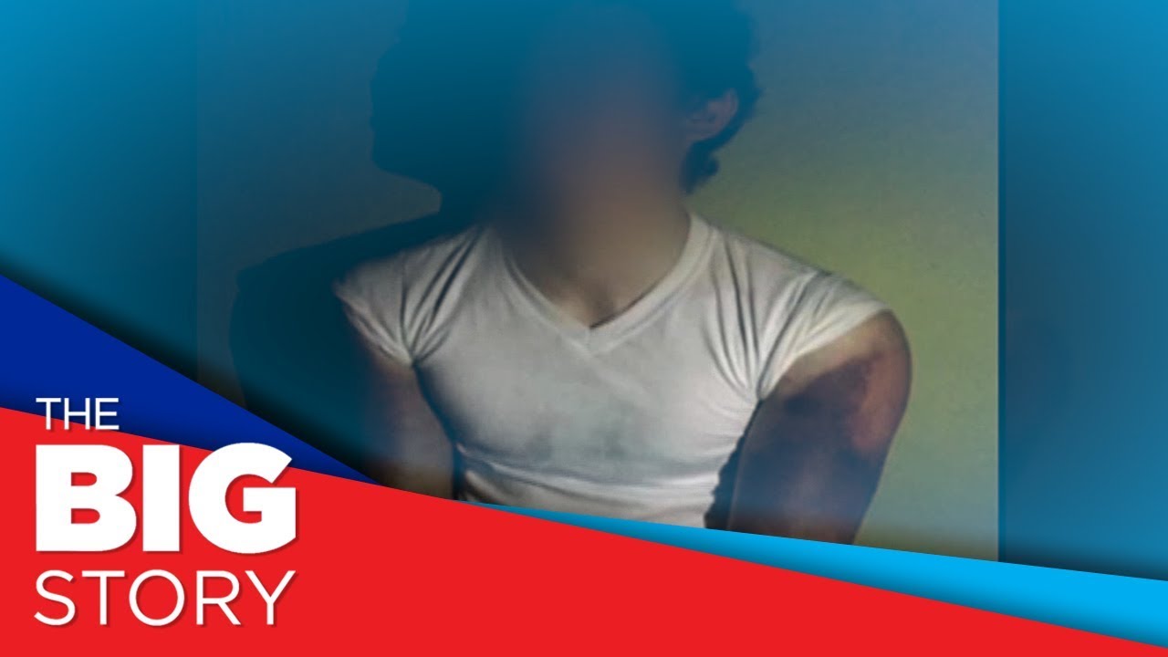 Screenshots of suspected hazing victim at UP go viral