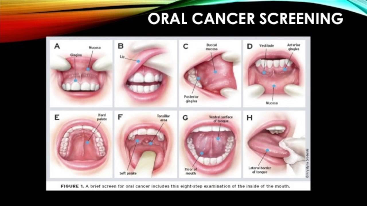 Parkland Dental Hygiene Identifying Normal Oral Structures