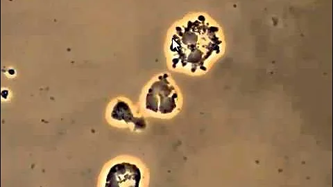 Bacteria attacking White Blood Cells