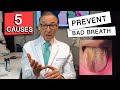 Top 5 CAUSES of BAD BREATH | How to Prevent it!