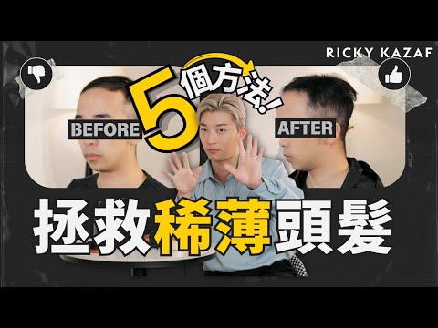 頭髮愈來愈薄點GEL頭？五個頭髮稀薄自救術 | RickyKAZAF