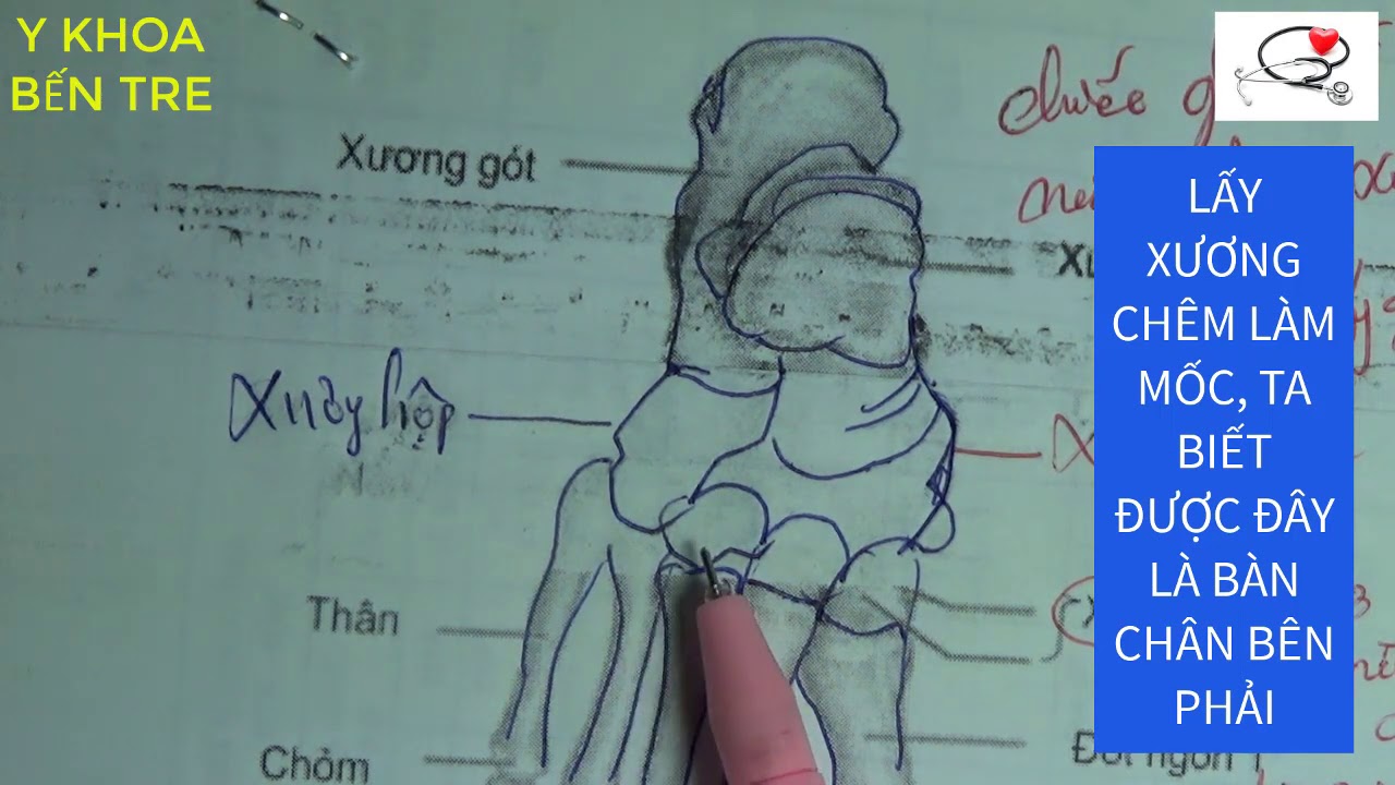 GIẢI PHẨU XƯƠNG BÀN CHÂN - MẸO HỌC TỐT - NHỚ DAI