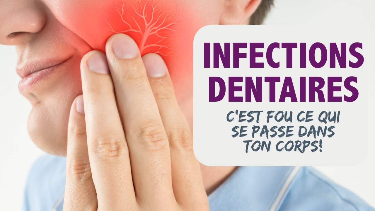 Infections dentaires : c'est FOU ce qui se passe dans ton corps !
