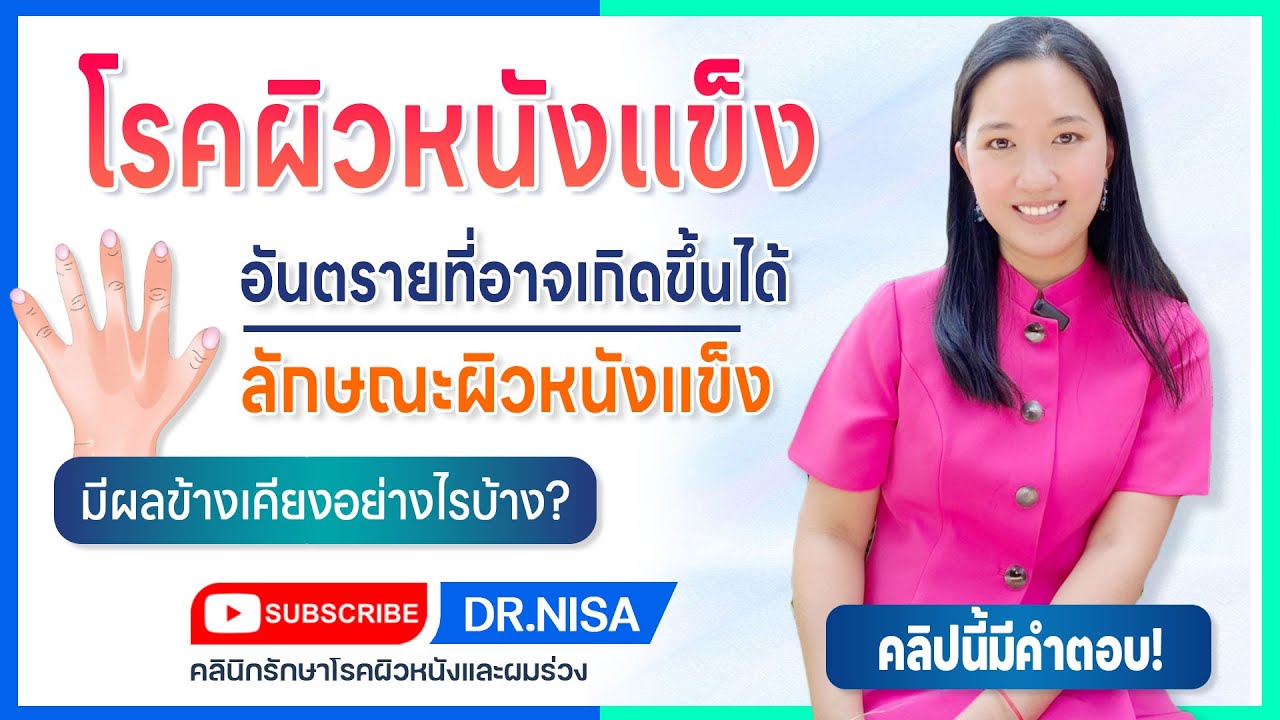 โรคผิวหนังแข็ง