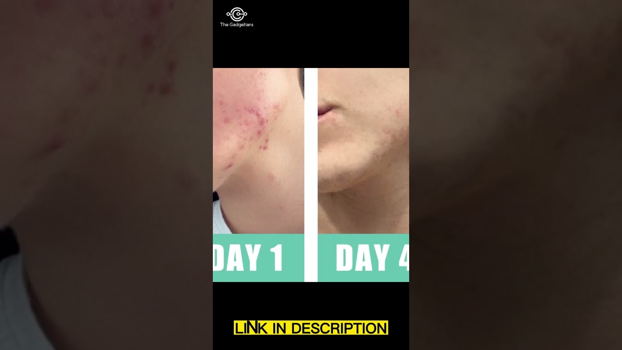 Repairing Skin with Active Skin Repair!