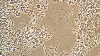 Spirochetes, the wiggly menace causing Gum Disease