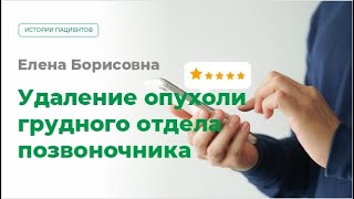 Удаление опухоли грудного отдела позвоночника. Отзыв пациента МЦ МИРТ