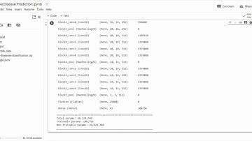 Eye Disease Detection Using Transfer Learning on VGG16