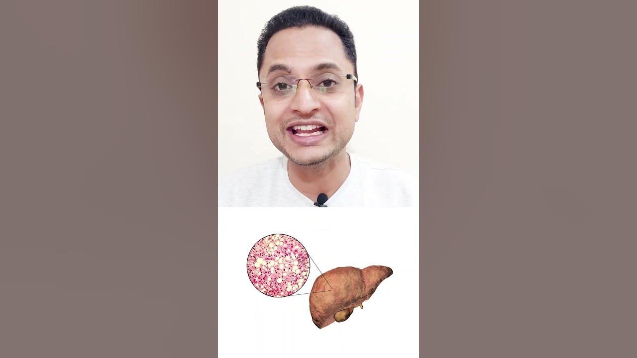 ayurvedic-treatment-for-liver-disease-phalatrikadi-kwath-benefits