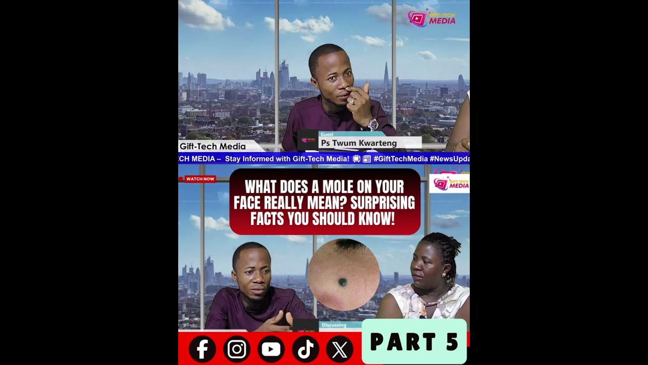 PART 5 👀 What Does a Mole on Your Face Really Mean? Surprising Meanings You Should Know! ✨