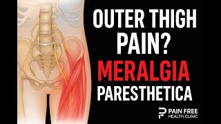 Meralgia Paresthetica Explained | Burning, Tingling, or Numbness in the Outer Thigh