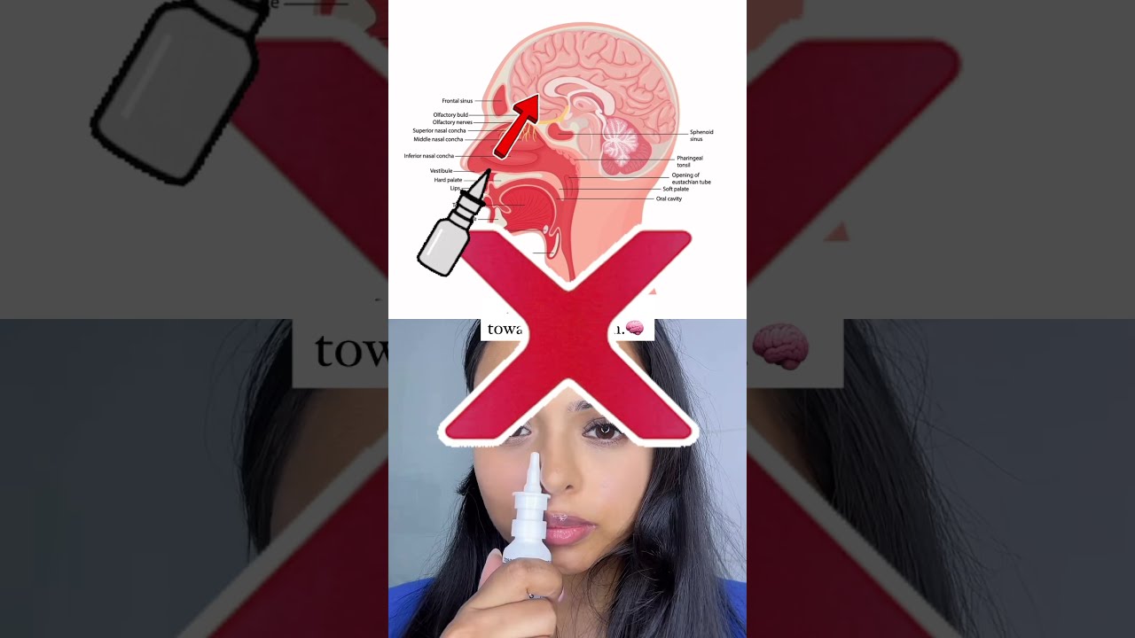 How To Use Nasal Spray Correctly Nasalspray Health Medicine Lifehacks Fyp Viralshorts