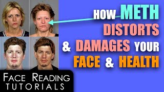 How Meth Distorts & Damages Your Face & Health