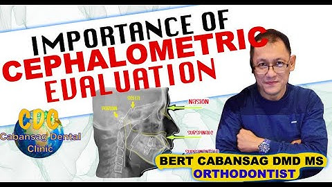 Cephalometric tracing/ evaluation for Orthodontics