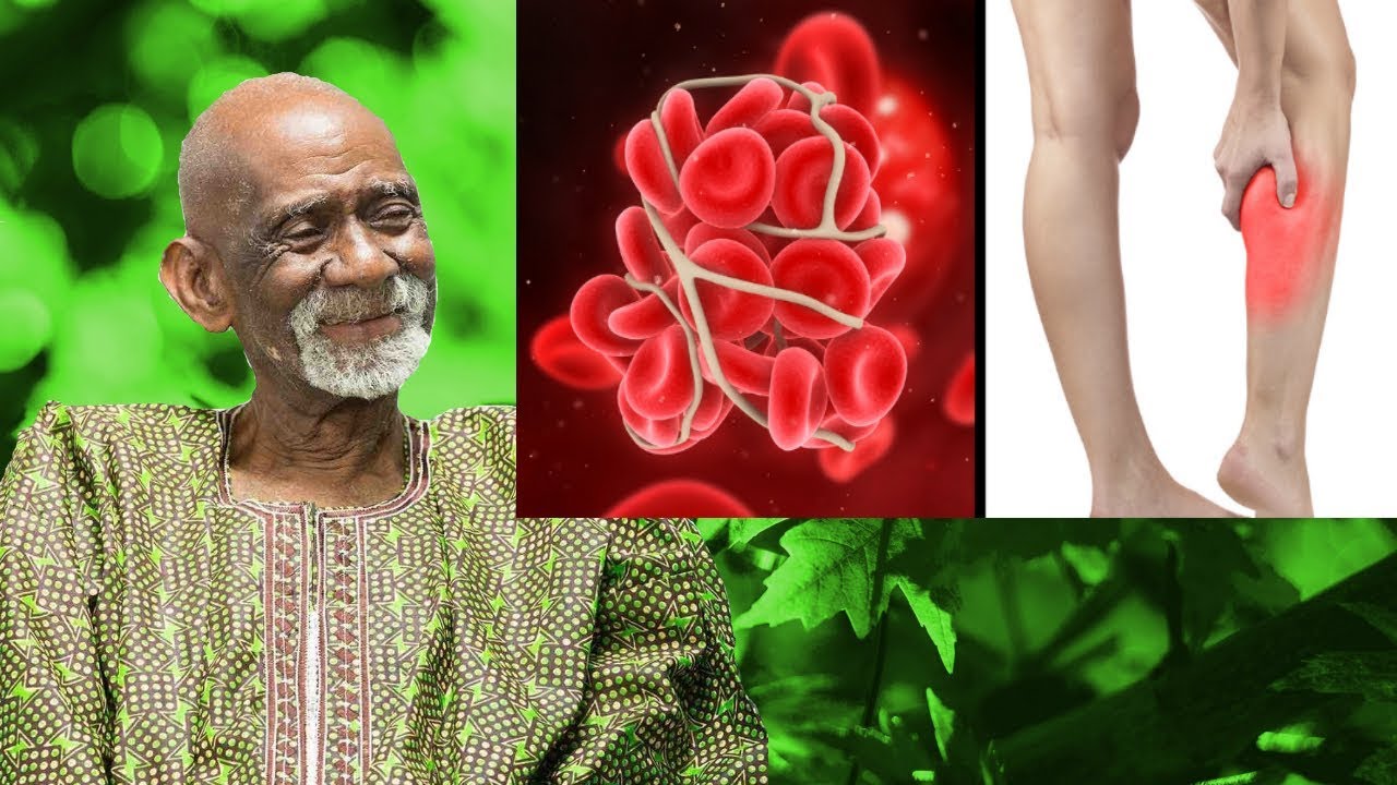 remedies for uti Dr Sebi - Natural Remedy For Blood Clots