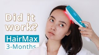 هل نجحت؟ مشط الليزر HairMax تحديث لمدة 3 أشهر