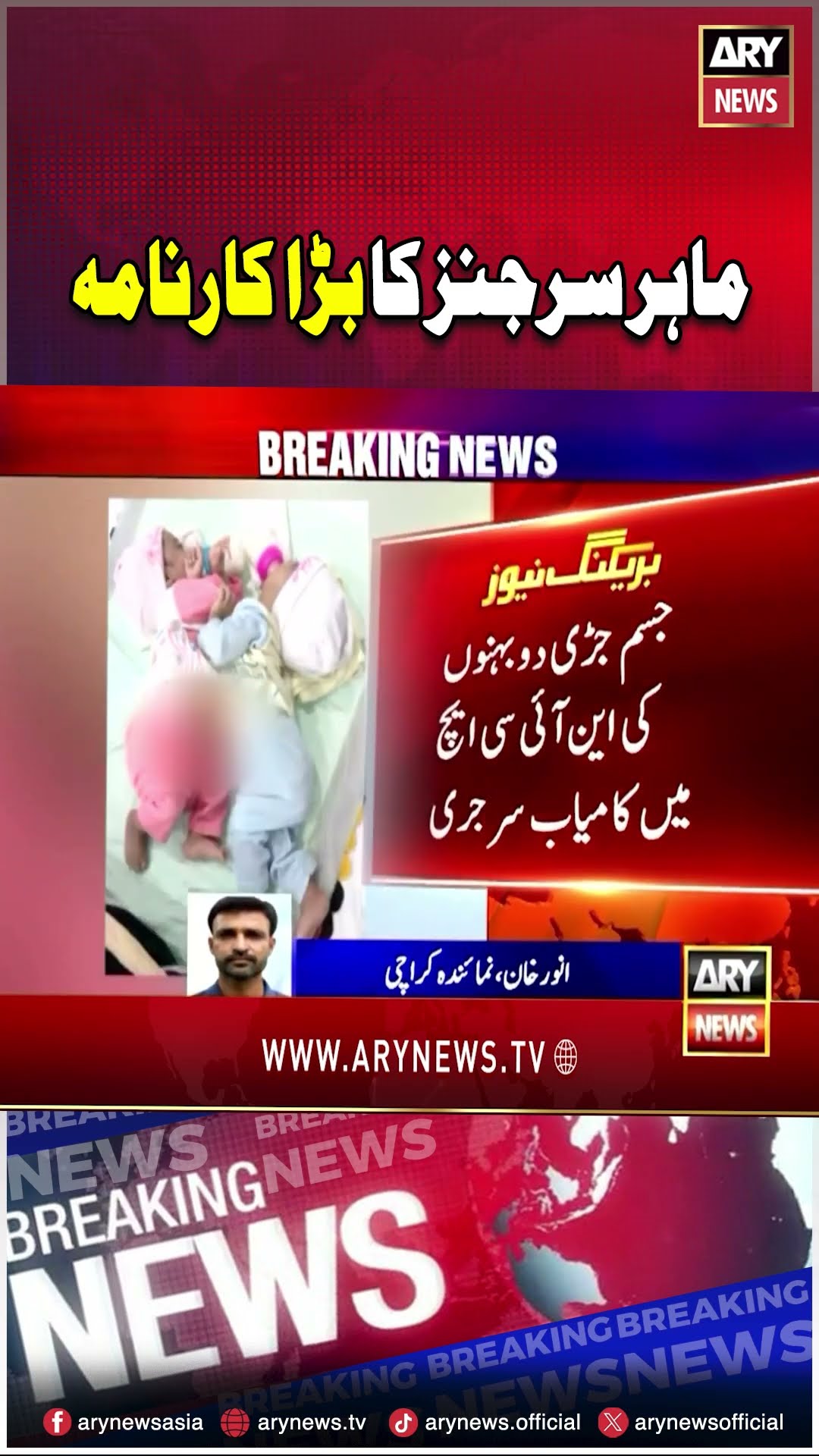Jism juri 2 behnon ki surgery #karachi #shorts #ytshorts #youtubeshorts #arynews