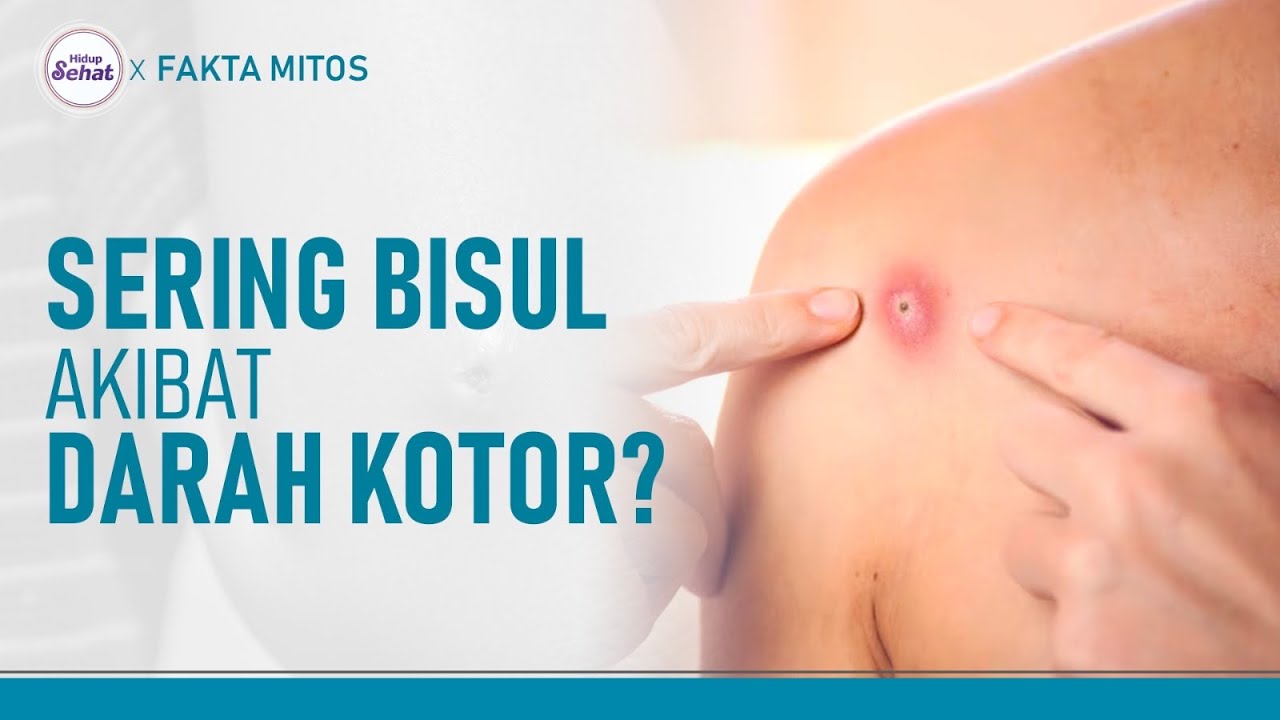 Benarkah Sering Bisul Itu Akibat Darah Kotor? | Hidup Sehat tvOne