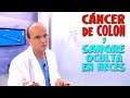 Cncer de colon y prueba de la sangre oculta en heces para su diagnstico  cncer 12