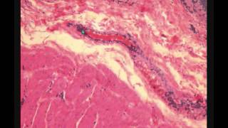 МОЧЕВОЙ ПУЗЫРЬ гистологическое строение URINARY BLADDER МОЧЕВОЙ ПУЗЫРЬ гистологическое строение URINARY BLADDER