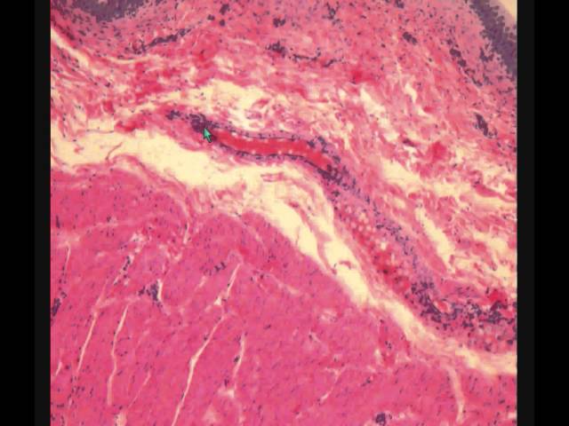 МОЧЕВОЙ ПУЗЫРЬ гистологическое строение URINARY BLADDER