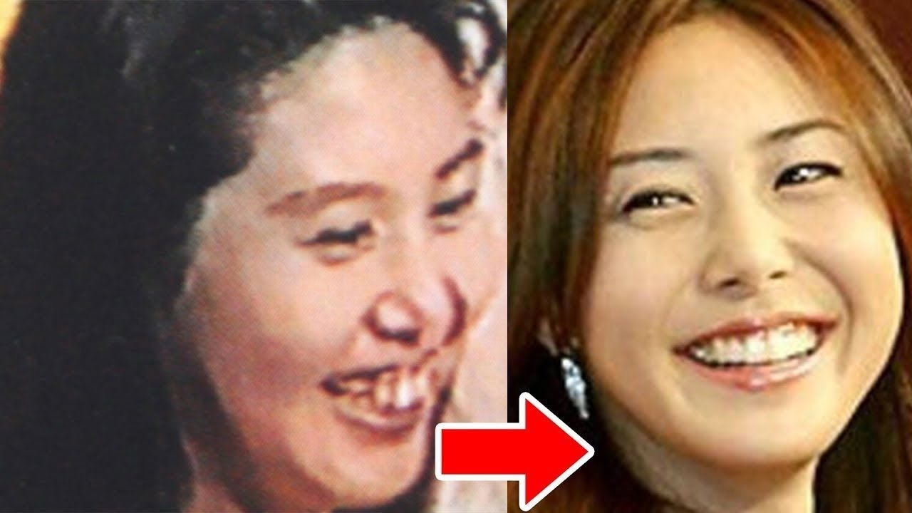 エンタメ 松嶋尚美に 余命13年 宣告 肺年齢は74歳 慢性閉塞性肺疾患が判明 Buzzにゅ Youtube エンタメ 松嶋尚美に 余命13年 宣告 肺年齢は74歳 慢性閉塞性肺疾患が判明 Buzzにゅ Youtube