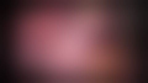 Appendicitis - Appendicular  abscess  -  laparoscopy