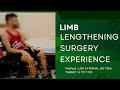 Limb lengthening surgery patients experience lon external method on tibia   dr amar sarin