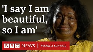 'I say I am beautiful, so I am' - 100 Women, BBC World Service