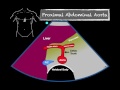 Bedside ultrasound abdominal aorta