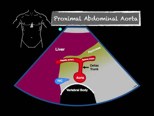 Bedside Ultrasound Abdominal Aorta class=