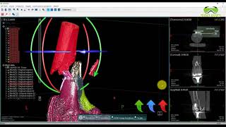 Ooopds - Knee 1 Ooopds Has Received Tfda Cl 2 Certification