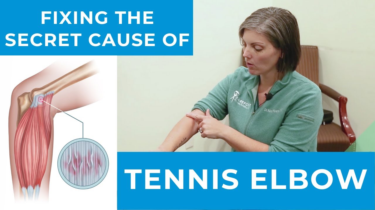 Fixing The Secret Cause of Tennis Elbow [NonSurgical Arm Pain Specialist Denville, NJ] YouTube