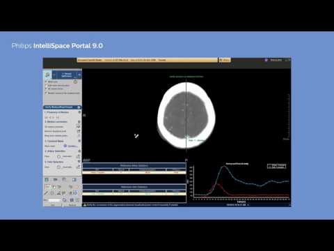 Philips IntelliSpace Portal 9.0 clinical application CT Brain Perfusion