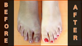 FEET WHITENING PEDICURE (at home) - Remove SUN TAN & WHITEN YOUR SKIN