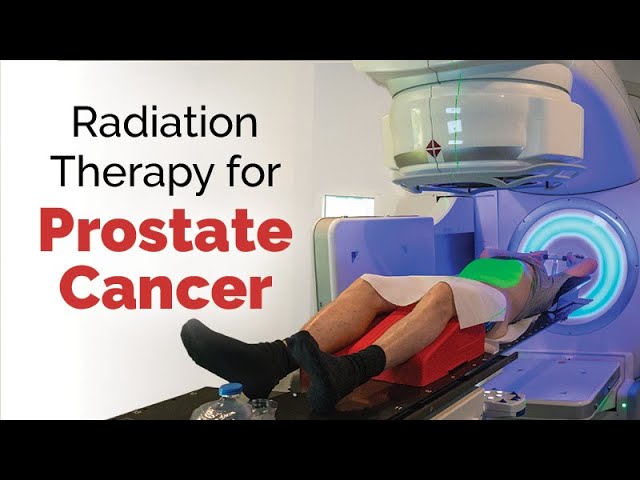 Radiation Therapy for Prostate Cancer class=