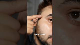 Best cream for uneven skintone😍✅!|#ytshorts #skincare #grooming #beauty