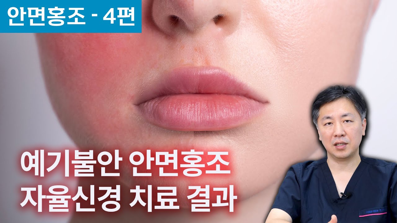 긴장, 불안, 초조한 감정으로 얼굴이 확 빨개지는 홍조, 개선 신호와 치료 결과는? l 감정홍조 4편 - YouTube