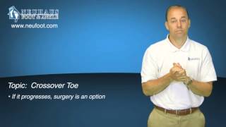 What is Crossover Toe? A Tennessee Podiatrist Explains