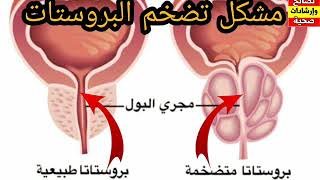 الدكتور محمد الفايد مشكل تضخم البروستات