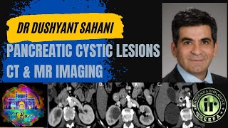 PANCREATIC CYSTIC LESIONS | DR DUSHYANT SAHANI | IPMN | MRI IN PANCREAS screenshot 1