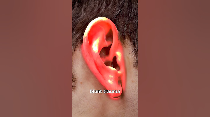 Why Athletes Get Cauliflower Ear 😬 (yikes)