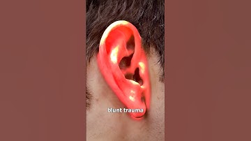 Why Athletes Get Cauliflower Ear 😬 (yikes)