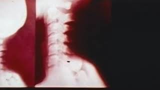 The Manitou TV Spot #4 (1977) (low quality)