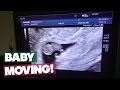 8 WEEK ULTRASOUND! BABY ALREADY MOVING!!!