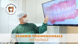 Non più fastidiose impronte dentali grazie allo scanner tridimensionale