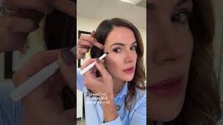 Botox Map | Beleza Clinic